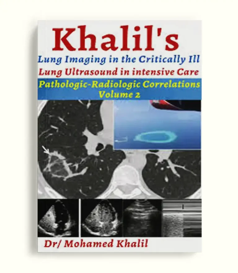 Khalil Lung Imaging in the Critically Ill two volumes cover