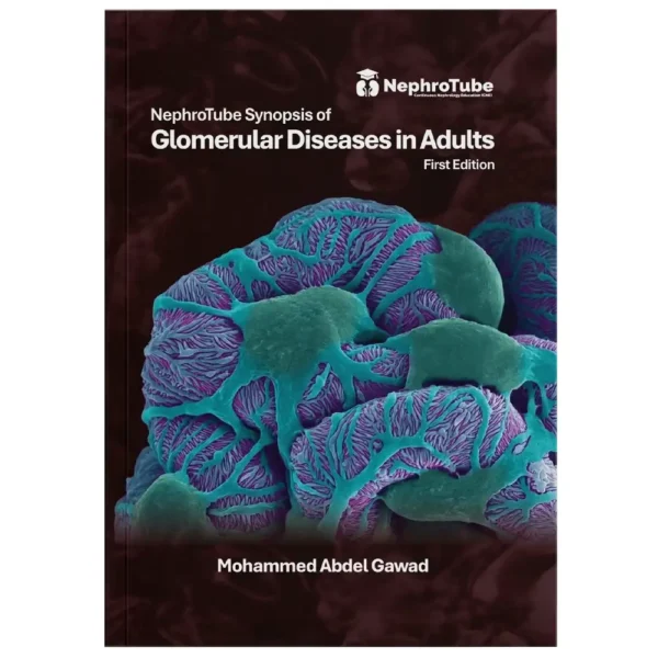 NephroTube Synopsis of Glomerular Diseases in Adults – Mohamed Abdel Gawad