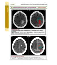 Notes and Notes for MRCP – صفحات من جوه السيت (عينة)