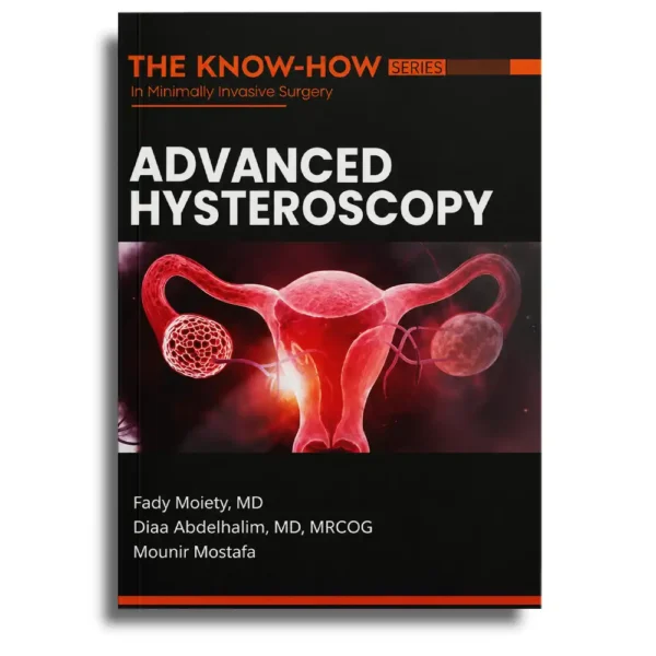 The Know-How Series Advanced Hysteroscopy