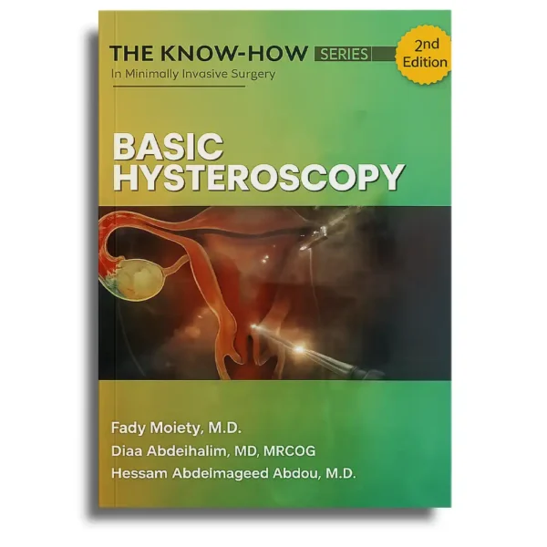 The Know-How Series Basic Hysteroscopy