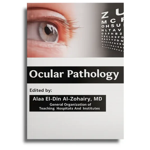 Ocular Pathology – Alaa El-Din Al-Zohairy